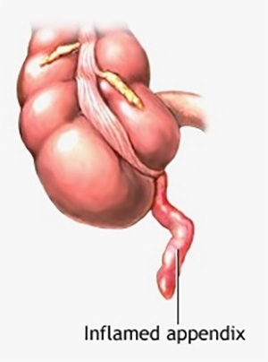 Appendix
