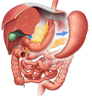 CT Pancreas