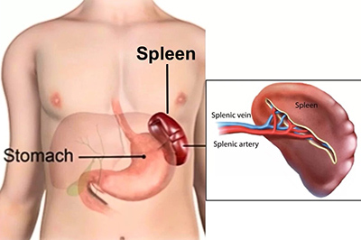Spleen Conditions Img